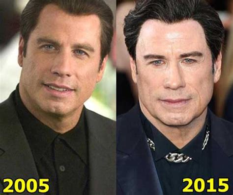 john travolta face lift|John Travolta Plastic Surgery: Before and After His Botox and。